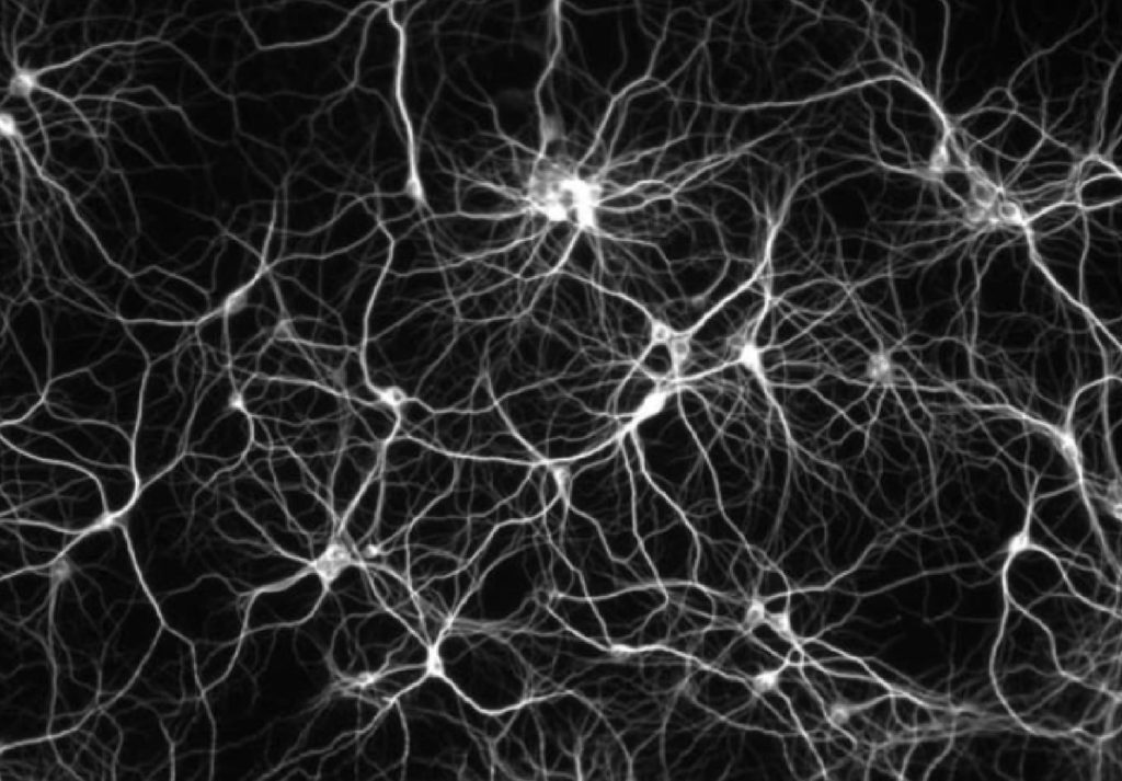 Photo du scan d'une synapse